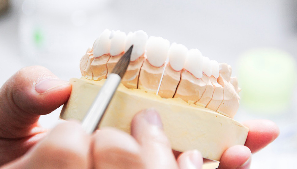 Răng sứ đạt chuẩn chất lượng ISO 9001:2015 của hệ thống Nha khoa Kim