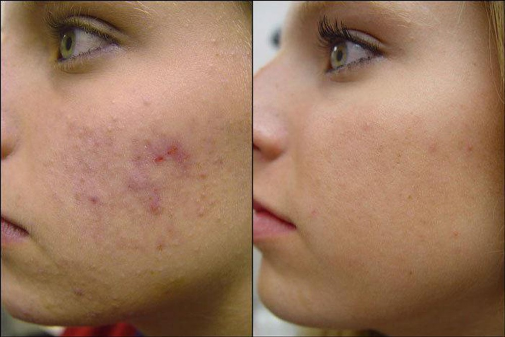 Hiệu quả của Scar Esthetique được người dùng kiểm chứng