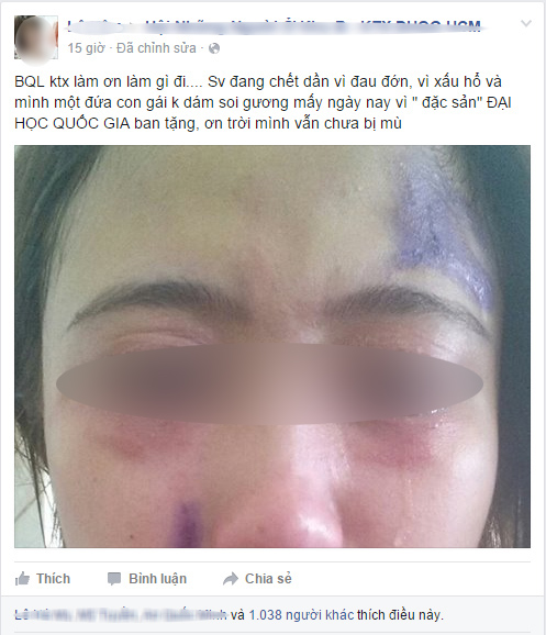 Nhiều sinh viên nữ còn đau đớn hơn vì lo lắng những hệ quả do kiến ba khoang để lại - Ảnh chụp màn hình