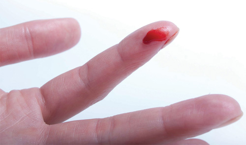 Với người bệnh máu khó đông, chỉ một vết thương nhỏ cũng sẽ trở thành vấn đề nghiêm trọng - Ảnh: Shutterstock 