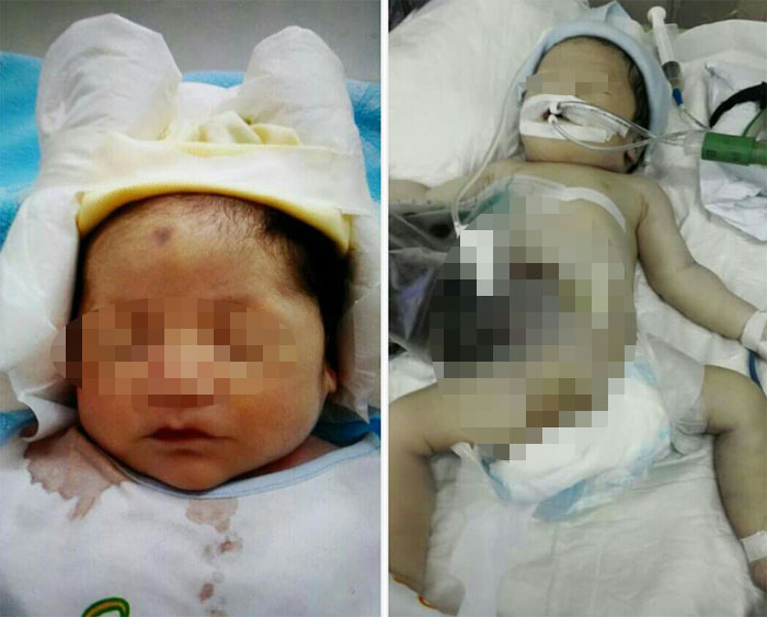Cháu bé sơ sinh bị “ruột trào khỏi bụng” tử vong - Ảnh: ảnh gia đình cung cấp