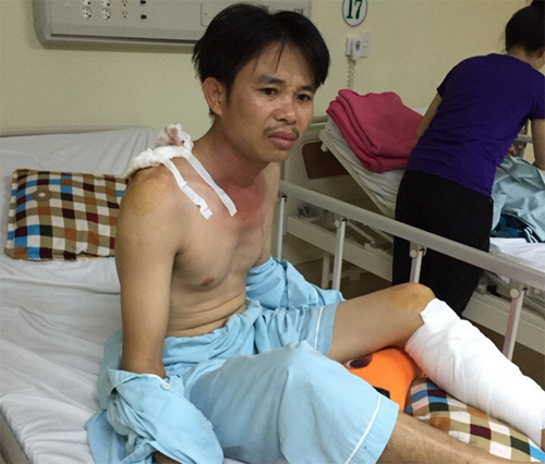 Anh Nhơn bị vết thương ở vai và chân gây đứt dây chằng - Ảnh: Nguyễn Long