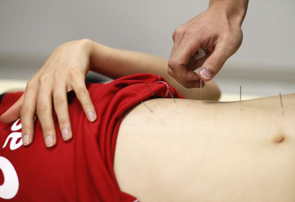 Châm cứu ở cổ tay giúp giảm huyết áp cho bệnh nhân không dùng thuốc cao huyết áp - Ảnh: Reuters