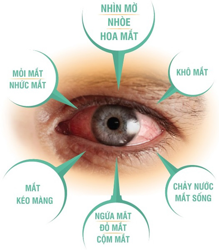 Nhiều triệu chứng và bệnh mắt có nguồn gốc từ sự suy yếu của RPE