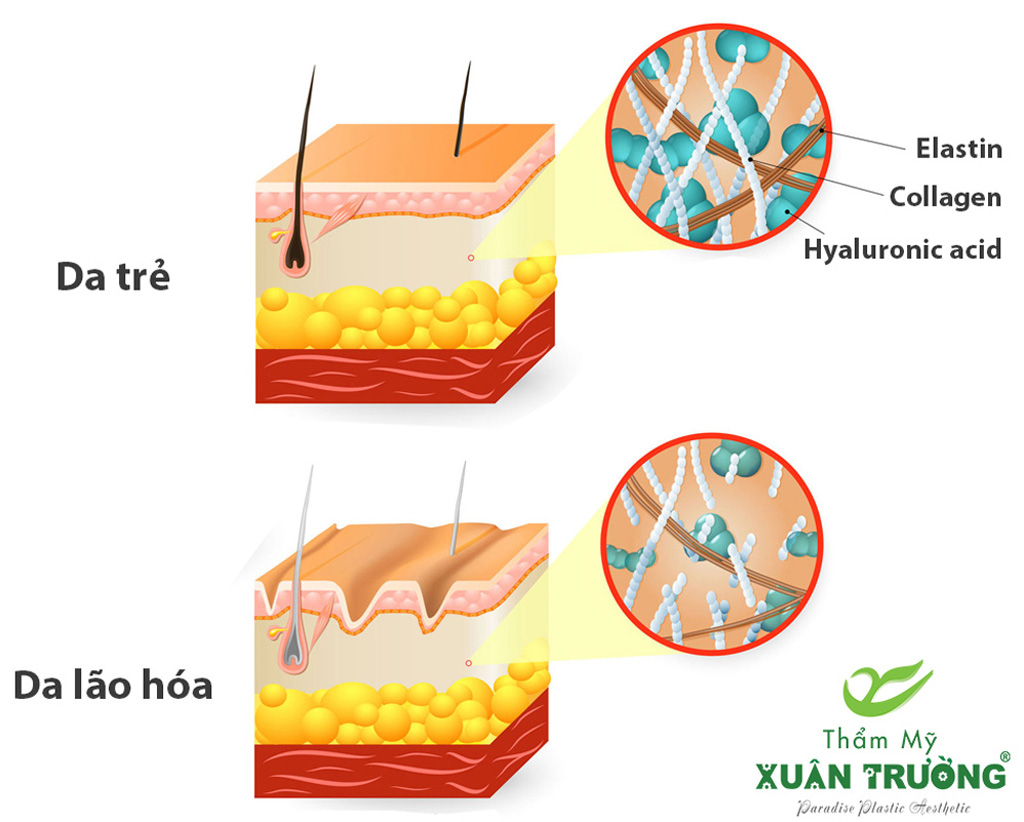 Sự đứt gãy của các sợi collagen và elastin là một phần của lão hóa da