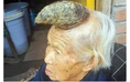 Cụ bà mọc ‘sừng’ kỳ lân trên đầu ở Trung Quốc