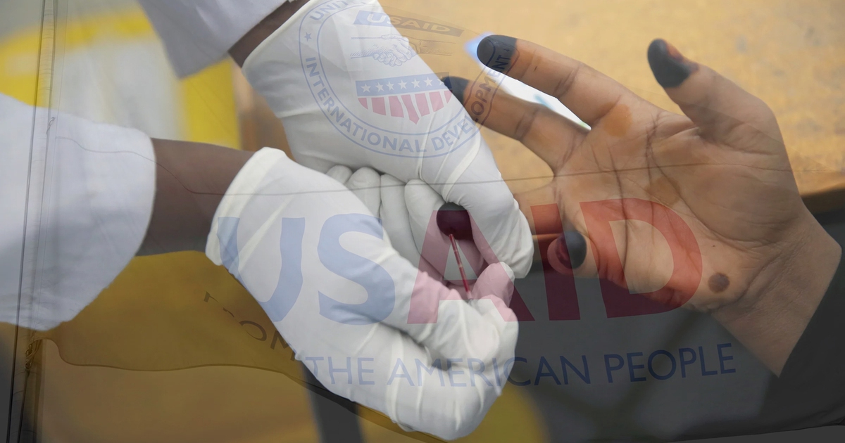 Mỹ rút hỗ trợ HIV/AIDS, tính mạng hàng triệu người bị đe dọa