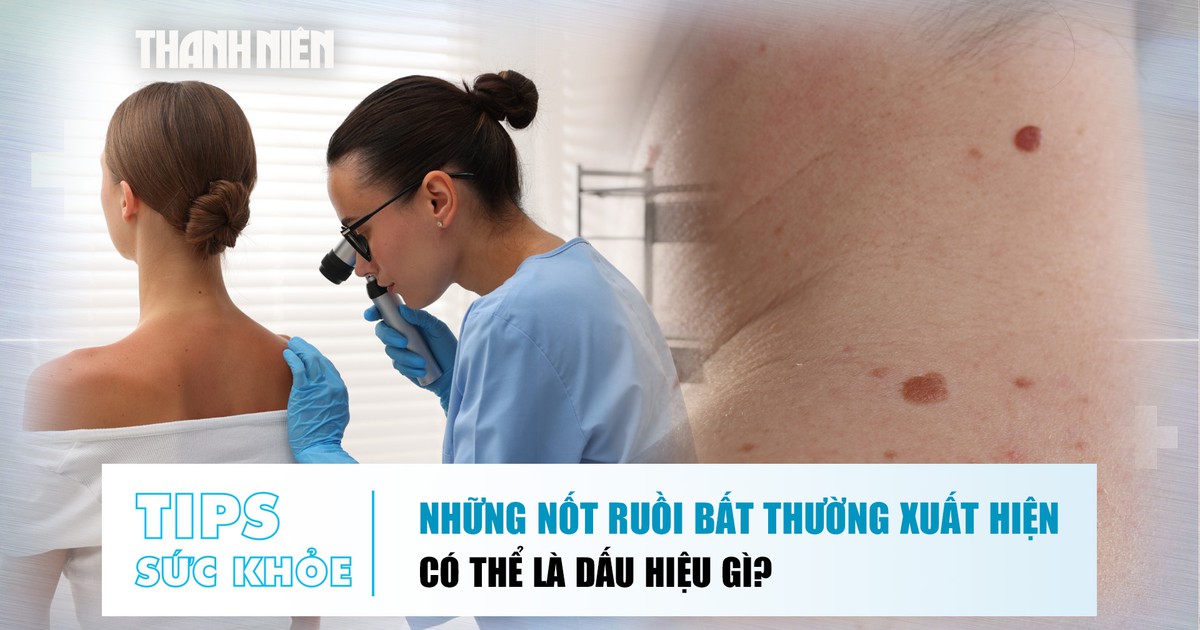 Bản tin sức khỏe 15.7: Nốt ruồi bất thường xuất hiện trên da có thể là dấu hiệu gì?