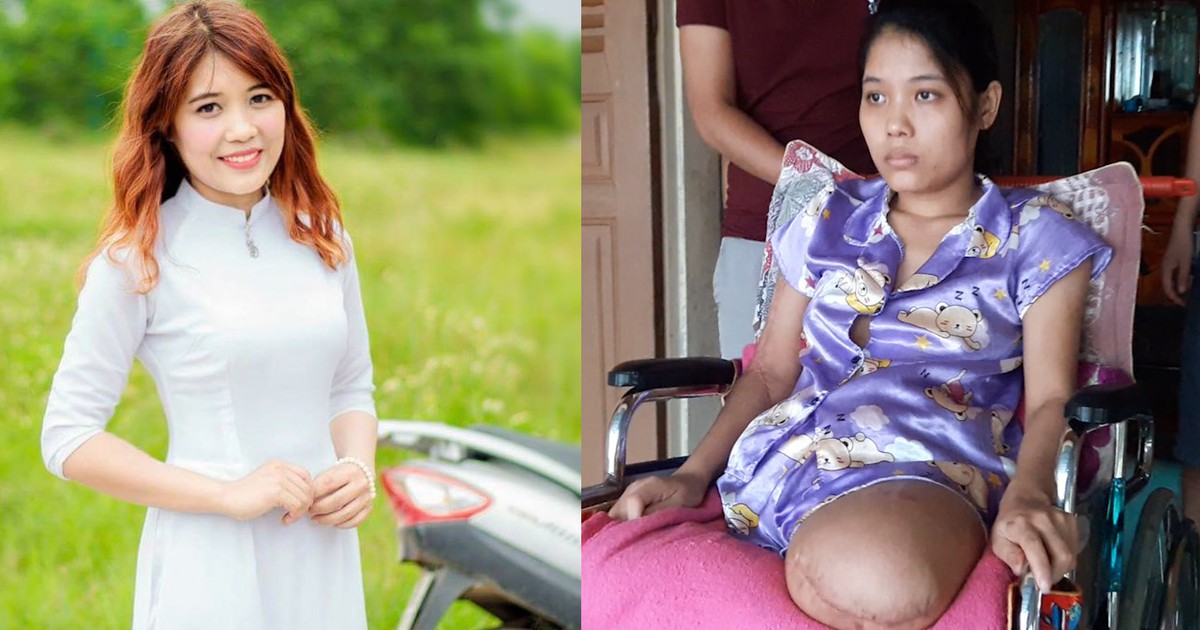 CHẠM VÀO ƯỚC MƠ | Giúp nữ cử nhân xinh đẹp mất hai chân bước vào hành trình mới