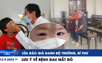 Xem nhanh 12h: Lừa đảo giả danh bộ trưởng, bí thư | Lưu ý về bệnh đau mắt đỏ