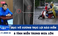 Xem nhanh 12h ngày 15.11: Ớn lạnh chiêu trò đục vỡ xương trục lợi bảo hiểm | 8 tỉnh miền Trung mưa lớn