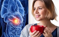 Phát hiện loại trà có thể tiêu diệt các tế bào ung thư