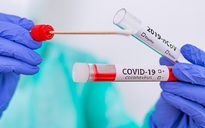 Mỗi người có nguy cơ tái nhiễm Covid-19 bao nhiêu lần?