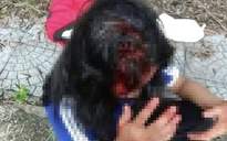Thừa Thiên - Huế: Xác minh vụ nữ sinh bị đánh chảy máu đầu vì không mua nước giúp bạn