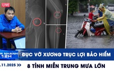 Xem nhanh 12h ngày 15.11: Ớn lạnh chiêu trò đục vỡ xương trục lợi bảo hiểm | 8 tỉnh miền Trung mưa lớn
