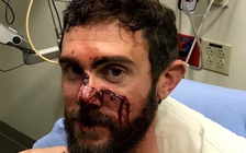 'Võ Tòng' Mỹ tay không đả chết sư tử núi