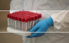 Tổng hợp dịch Covid-19 ngày 6.2: Nỗi lo từ ca bệnh ở sân bay Tân Sơn Nhất