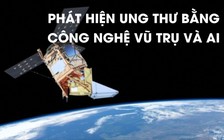 Công nghệ không gian 'se duyên" trí tuệ nhân tạo giúp phát hiện ung thư