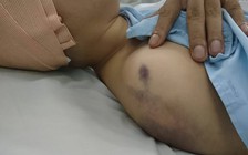 Nghi phạm vụ 'nổ súng, đâm dao ở Tân Bình' tử vong