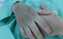 Cháu bé bị mẹ ruột và cha dượng 'tung cước' gãy chân xuất viện