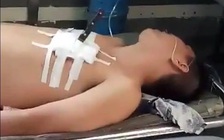 Cầm dao xông vào tiệm áo cưới đâm người rồi tự đâm vào ngực