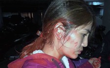 Tiệm spa liên tục bị 'khủng bố' bằng sơn và mắm tôm