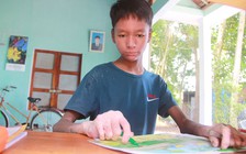 Cậu bé 'người rắn' với ước mơ trở thành họa sĩ