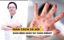 Giãn cách xã hội vì Covid-19 giúp giảm số lượng bệnh nhân tay chân miệng?