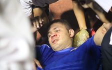 Gặp đa chấn thương vùng mặt, ngoại binh của Quảng Nam chia tay V-League sớm