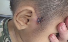 Bà mẹ 19 tuổi: "Thương quá hôn mạnh chứ không bạo hành" bé trai 4 tuổi