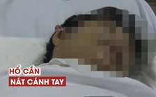 Người bị hổ cắn nát 2 tay tại Bình Dương kể lại khoảnh khắc kinh hoàng