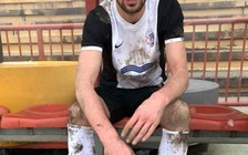 Sốc với vụ cầu thủ Croatia qua đời trên sân vì bóng trúng ngực