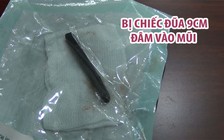 Bị chiếc đũa 9cm đâm vào mũi, 4 năm sau mới hay