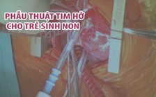 Phẫu thuật tim hở cho trẻ sinh non nhẹ ký nhất từ trước đến nay