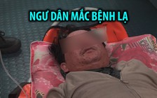 Cứu ngư dân mắc bệnh lạ có khả năng lây nhiễm