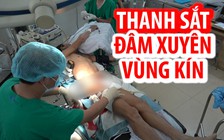 Cứu nam công nhân bị 2 thanh sắt đâm xuyên vùng kín