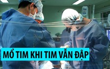 Một ngày, liên tiếp mổ tim thành công cho 2 bệnh nhân bằng phương pháp đặc biệt