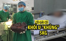 Khối u “khủng” nặng hơn 5 kg, dài nửa mét trong bụng cô gái