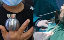 Thót tim cảnh bác sĩ giải cứu bé trai kẹt ngón tay trong ổ khóa