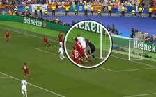 Bác sĩ kết luận: Karius mắc sai lầm vì bị Ramos chơi tiểu xảo