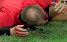 Sốc: trọng tài bị ném vỡ đầu tại Europa League