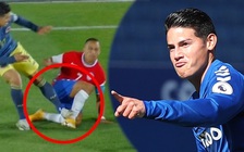 James Rodriguez hay lại còn may trước trận derby Merseyside Everton – Liverpool