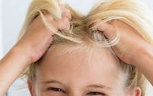 Muốn diệt chấy tóc? Đã có lược siêu âm!