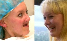 Kì diệu: Tái tạo hàm cho bệnh nhân ung thư bằng phương pháp in 3D