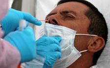 Mỹ lo nguy cơ mất kiểm soát dịch Covid-19, tổng thống Brazil nói có thể đã nhiễm bệnh