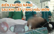 Bị biến chứng nặng sau khi cắt u nhú hậu môn tại phòng khám