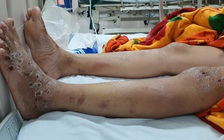 Cô gái bị đánh gãy xương sườn, dập lách, dập thận… vì từ chối kích dục, bán dâm