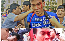 Xô xát đổ máu tại Era Town: Trách nhiệm quản lý của ai?