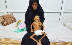 Yemen đối mặt nguy cơ nạn đói tồi tệ nhất lịch sử nhân loại