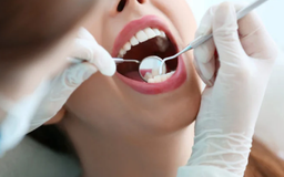 5 dấu hiệu ở răng miệng cảnh báo bạn nên gặp bác sĩ ngay